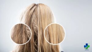 Does Bleaching Hair Cause Hair Loss